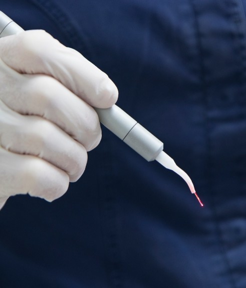 Gloved hand holding a pen like dental laser device