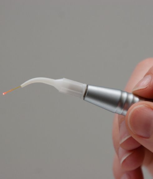 Close up of a hand holding a dental laser device