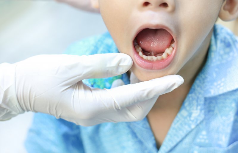 A dentist screening a child for a tongue-tie 