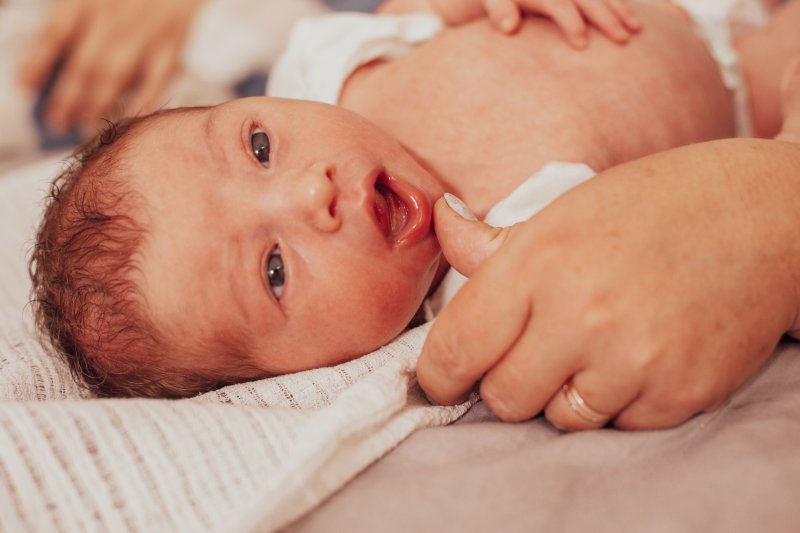 a baby with a tongue-tie